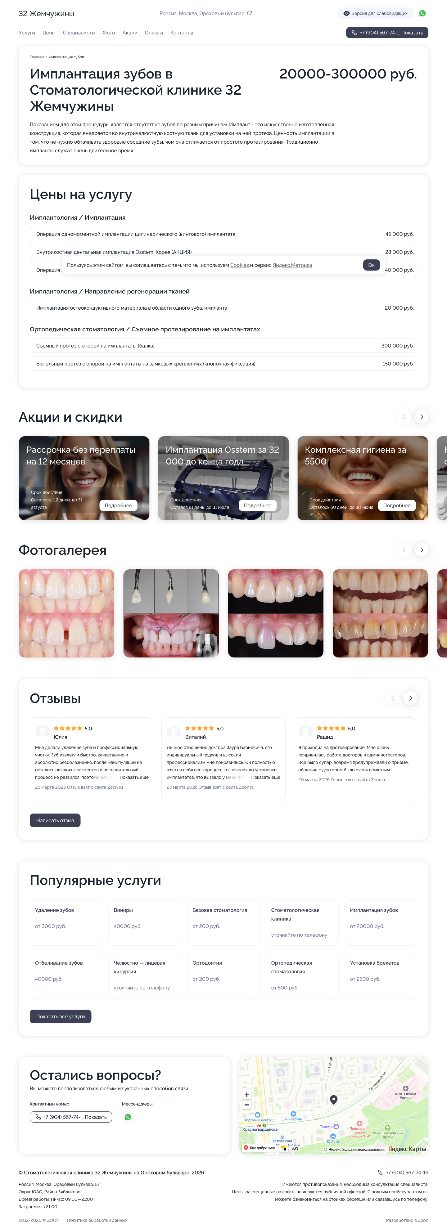 Имплантация